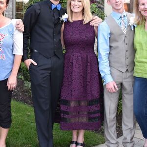 Alice and Olivia Lace Dress